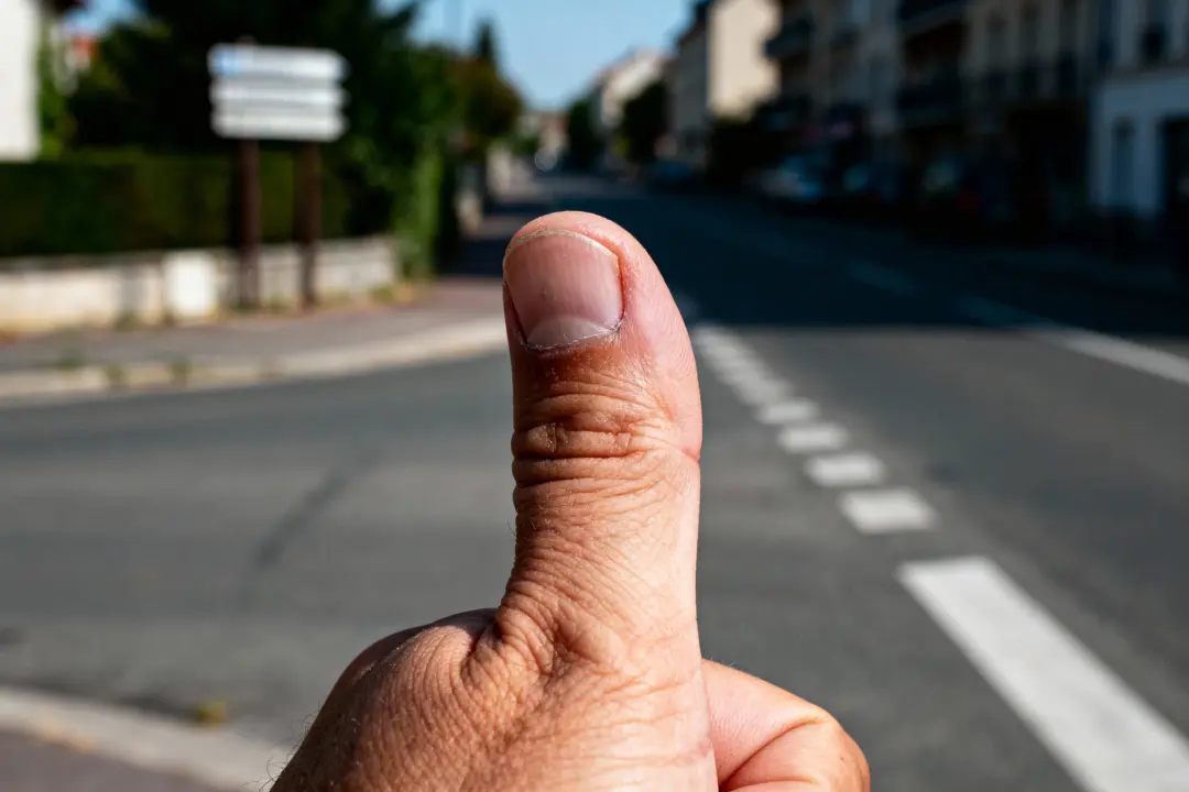 doigt gonflé et du mal à le plier