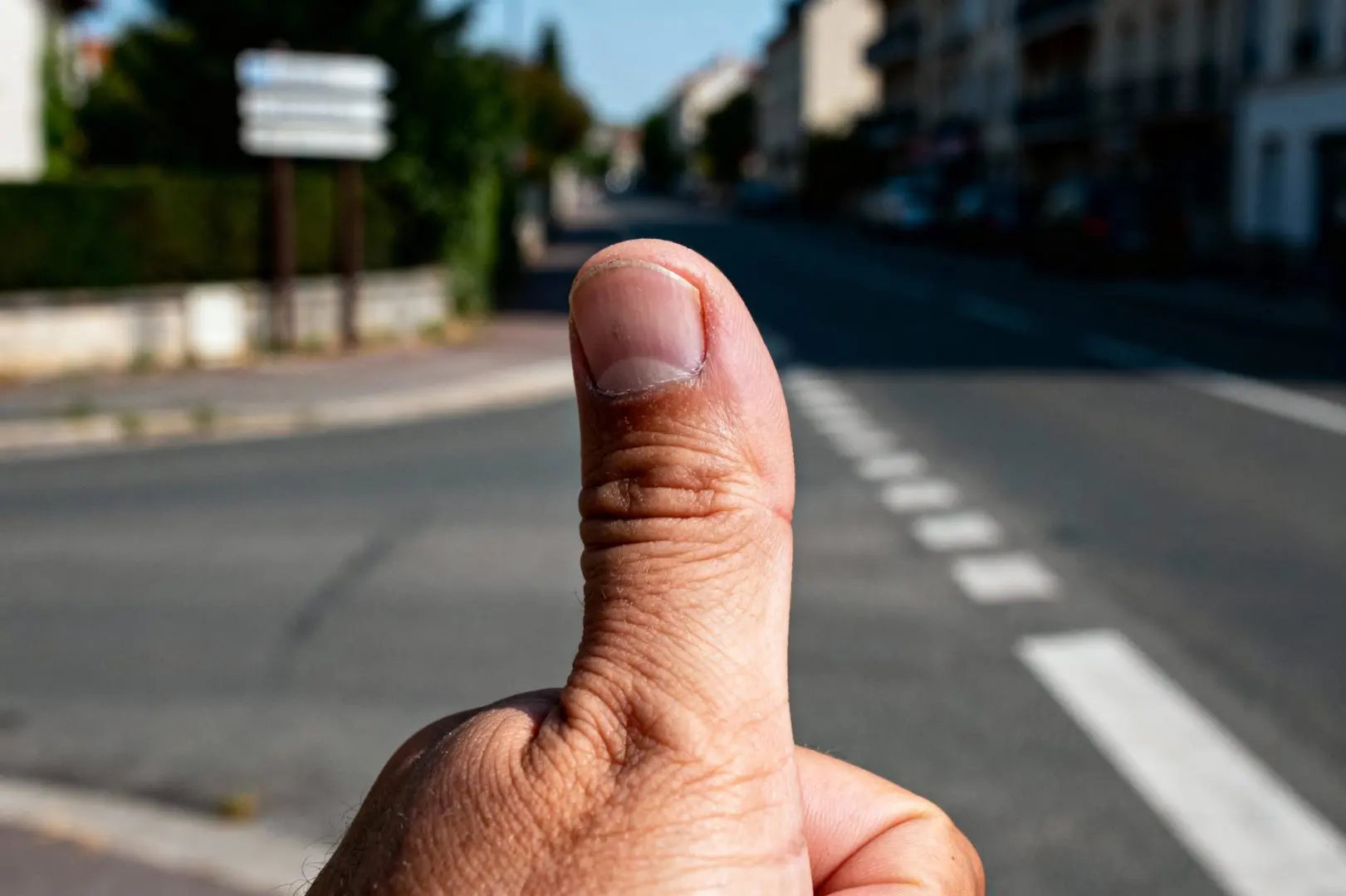 doigt gonflé et du mal à le plier