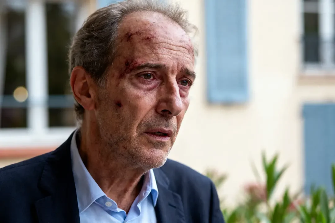 Homme âgé blessé, regard préoccupé, arrière-plan flou avec fenêtres et volets peints en bleu.